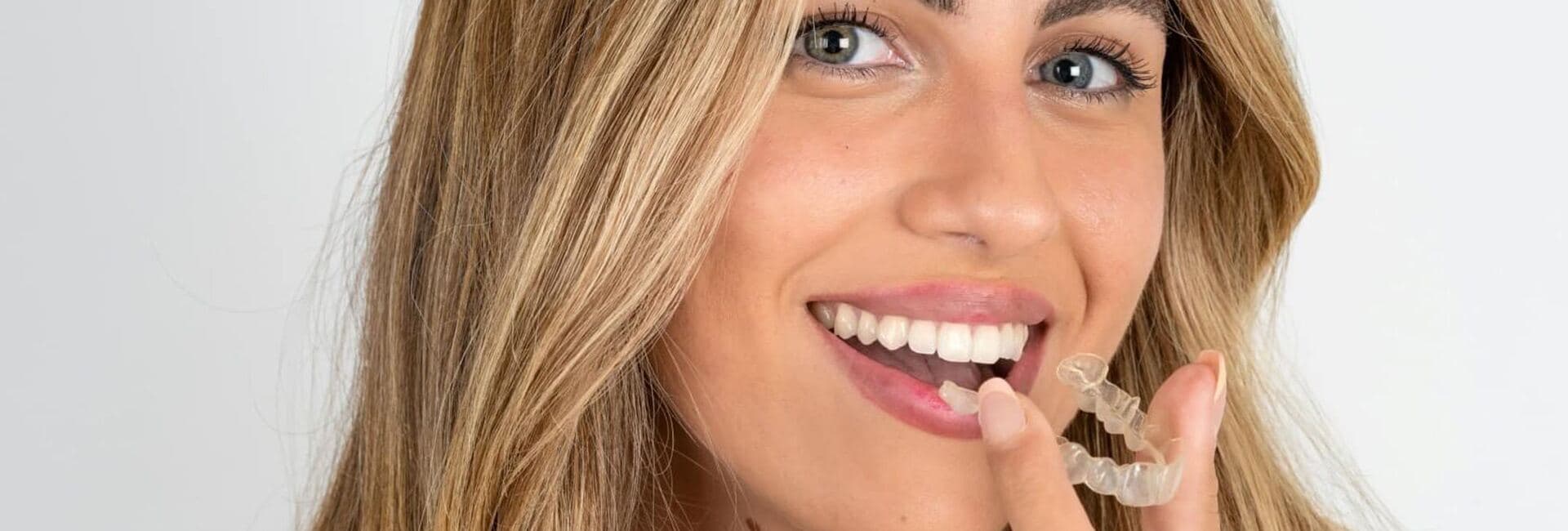 Orthodontic treatment with Invisalign and braces at West 17th Avenue Dental Care in SW Calgary