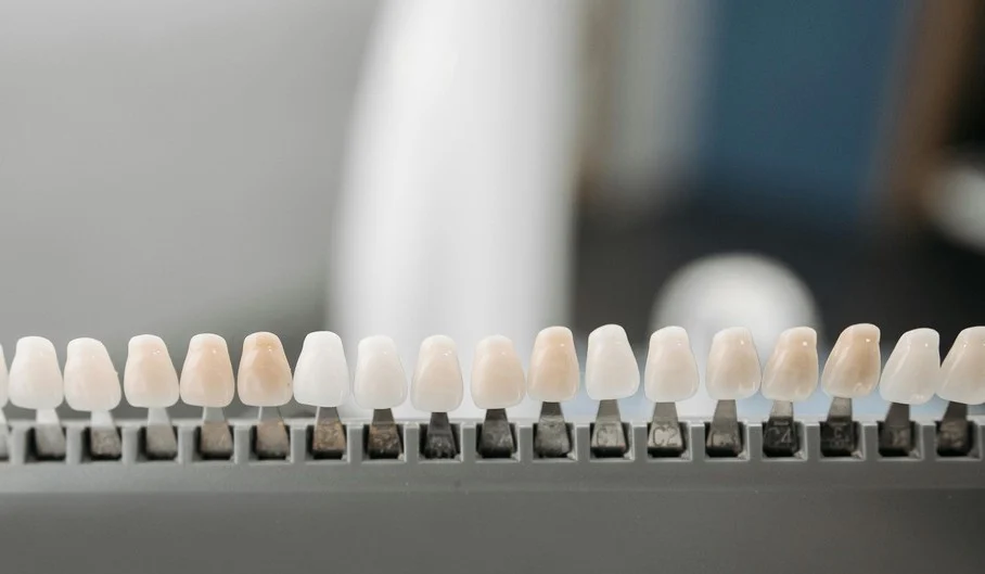 porcelain veneers